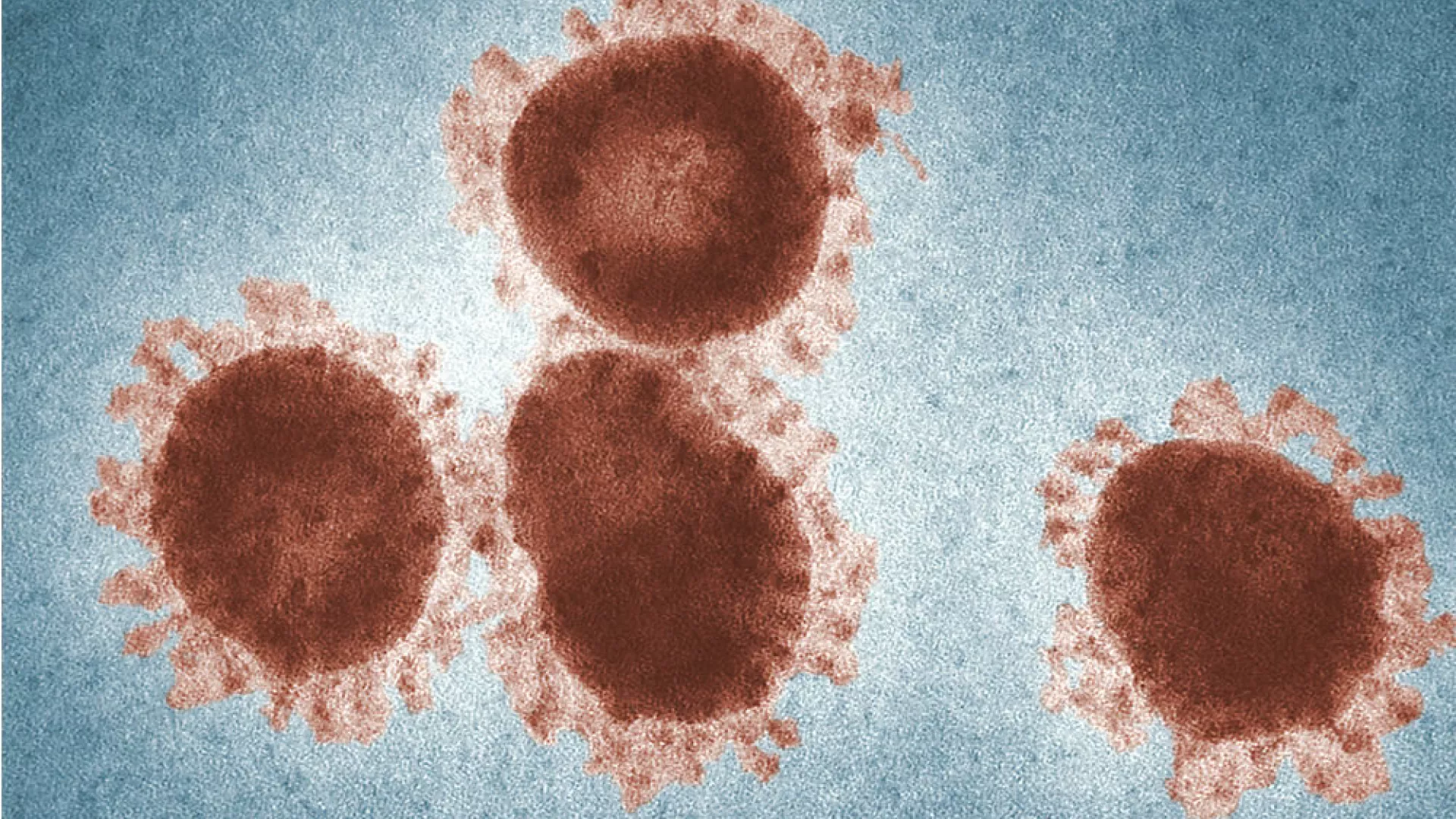 Coronavirus_1.jpg